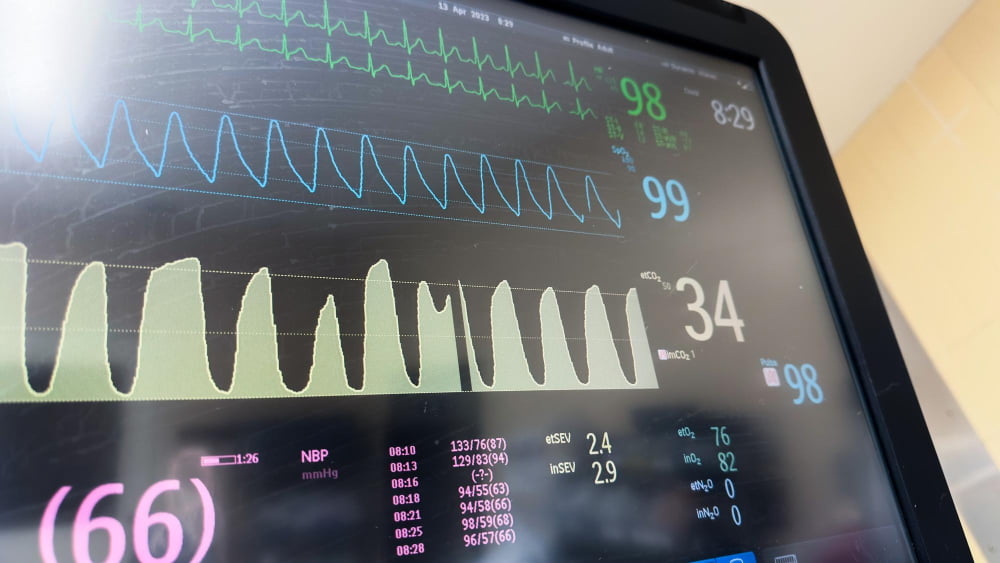 Co to jest elektrokardiogram? Przewodnik dla pacjenta i specjalisty