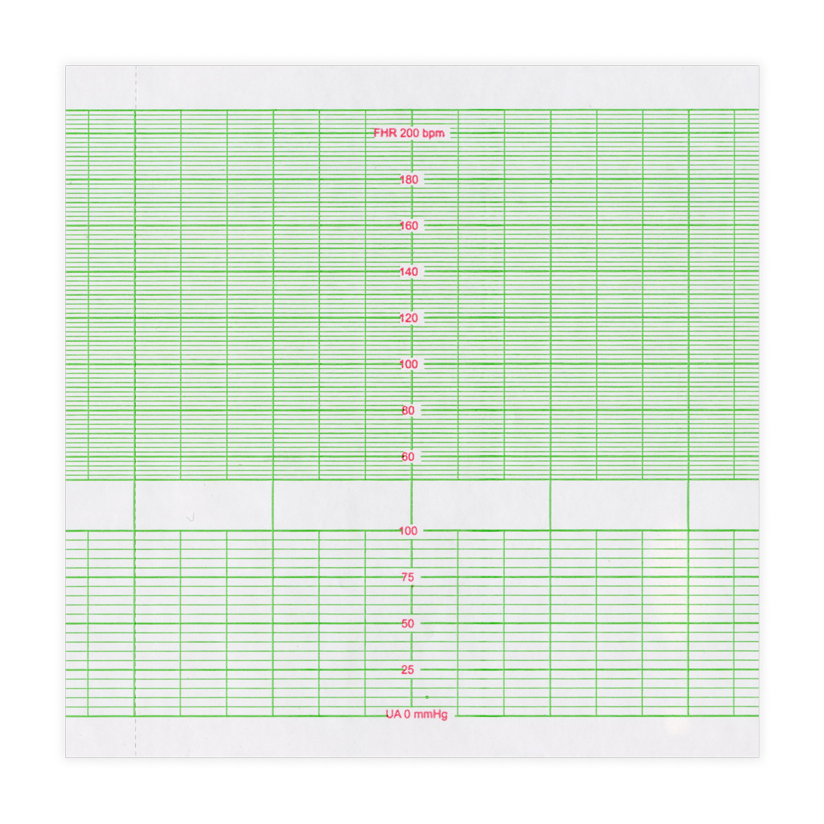 Papier KTG do Bionet Fetalcare FC-1400, 152 mm x 25 m, 1 opk. - 5 szt.